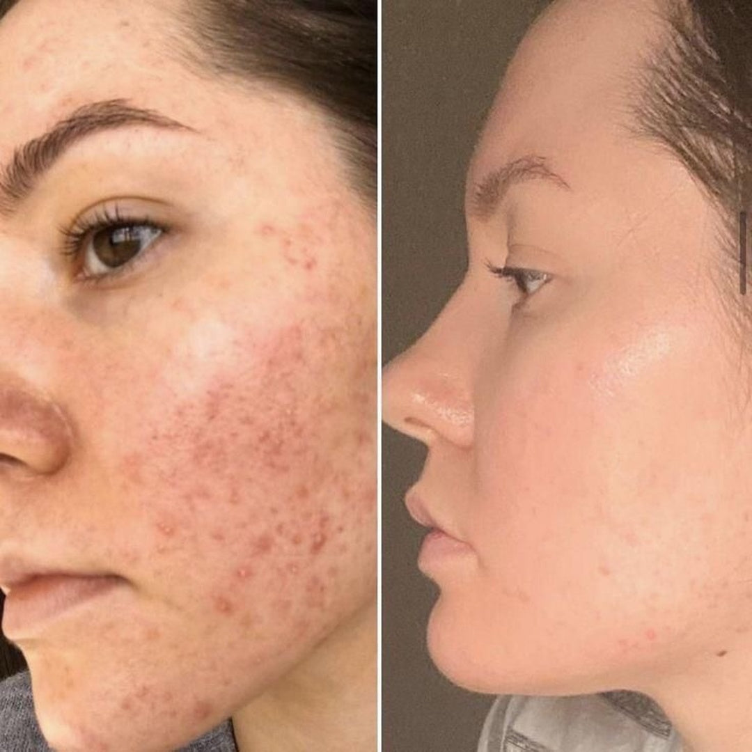 Korean serum for skin
